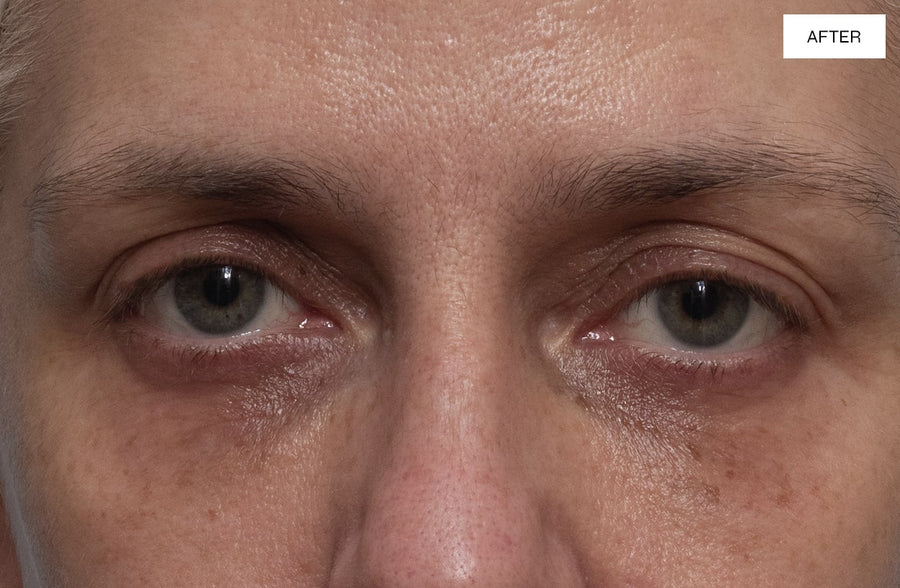 Dr. Sabrina™ Perfect 360 Eye Illuminate After