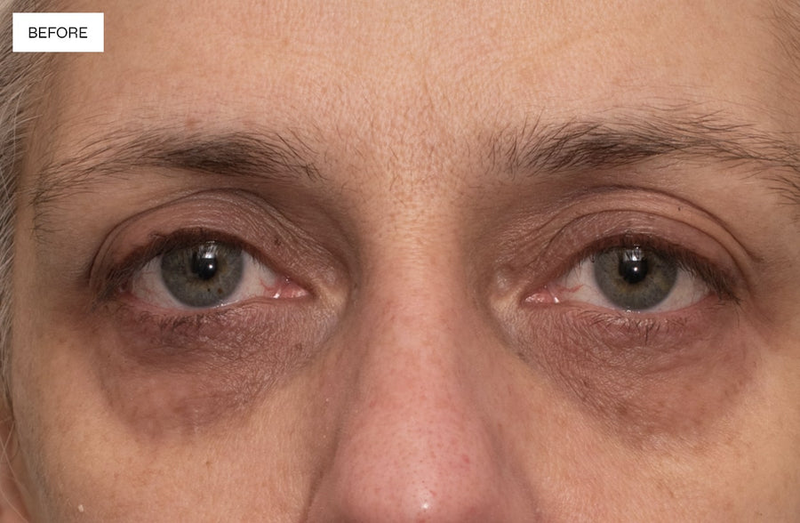 Dr. Sabrina™ Perfect 360 Eye Illuminate Before