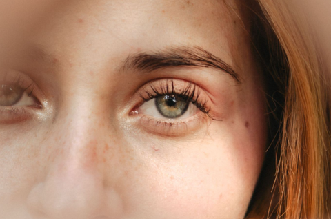 Azelaic Acid vs Niacinamide: Which Is Better for Sensitive Skin?