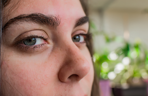 Dry eyelids: Causes and treatment