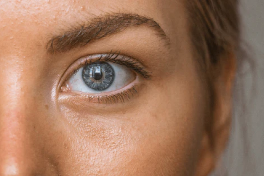 How to Get Rid of Eye Bags
