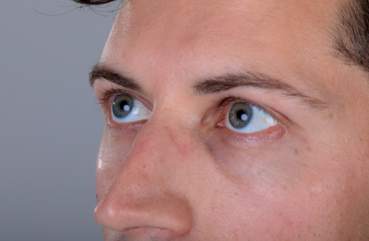 How to Get Rid of Dark Circles: The Ultimate Guide