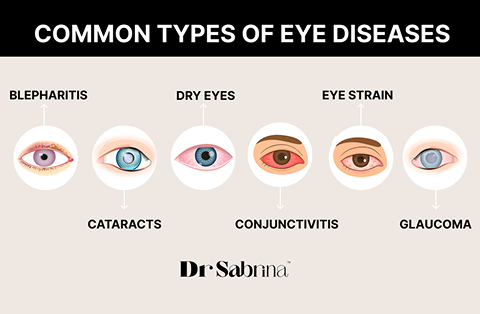 Common Eye Diseases: Complete Guide