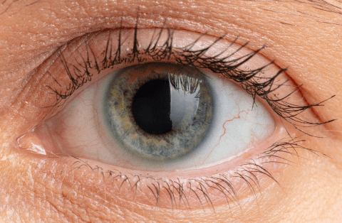 can cataracts be reversed?