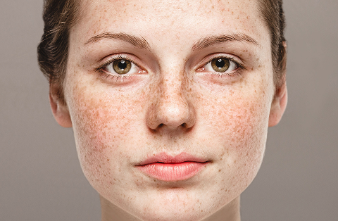 what causes dark spots on face