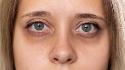 Reduce dark circles