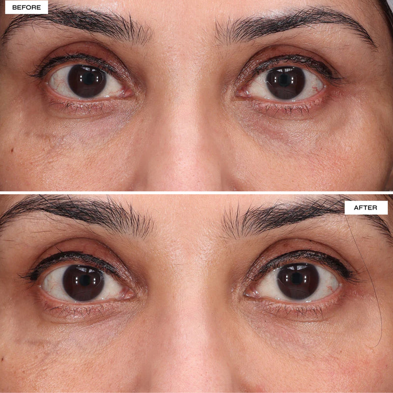 Dr Sabrina™ Eye Regenerate LED Mask