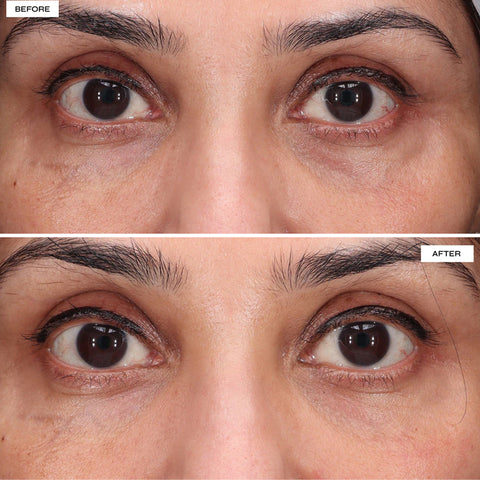 Dr Sabrina™ Eye Regenerate LED Mask